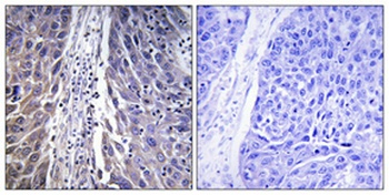 MRP-L15 antibody