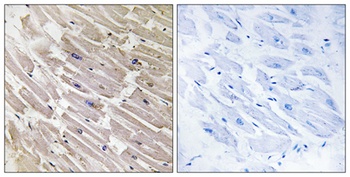 MRP-L16 antibody