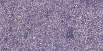MRP-L18 antibody