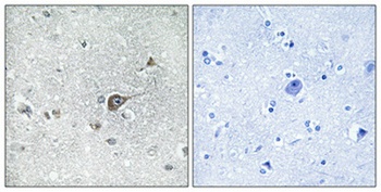 MRP-L20 antibody