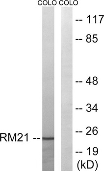 MRP-L21 antibody