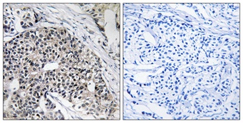 MRP-L24 antibody