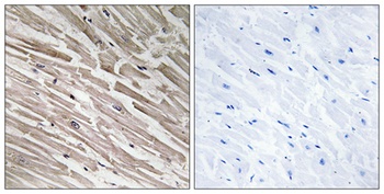 MRP-L44 antibody