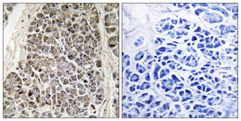 MRP-S21 antibody