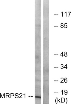 MRP-S21 antibody