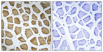 MRP-S22 antibody