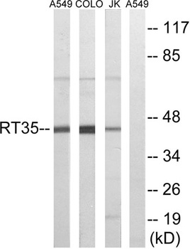 MRP-S35 antibody