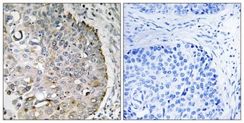 MRRF antibody