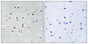 MRTF-A antibody