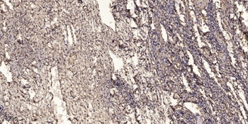 MTHFR antibody