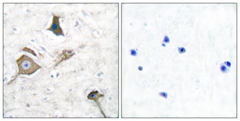 MMP-16 antibody