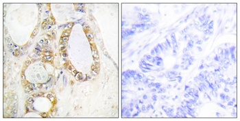 Mucin 13 rabbit pAb