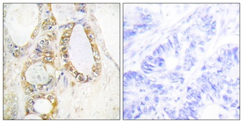 Mucin 13 antibody