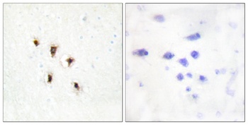 MVK antibody