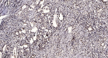 MYL3 antibody