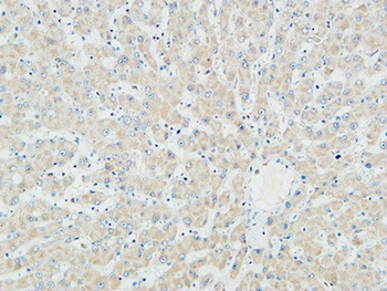 Myogenin antibody