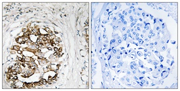 Myt 1 antibody