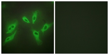 N33 antibody