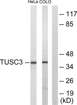 N33 antibody