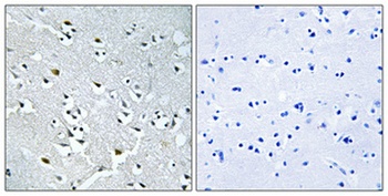 N4BP1 rabbit pAb