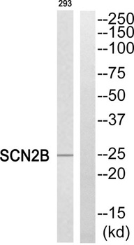 Na+ CP type II beta antibody