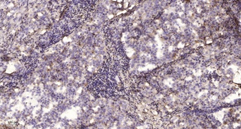 Na+ CP type IIβ rabbit pAb