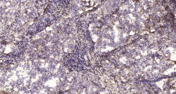 Na+ CP type II beta antibody