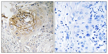 Na+ CP type IXα rabbit pAb Antibody