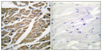 Na+ CP-pan antibody