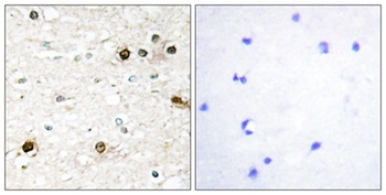 NAB2 antibody