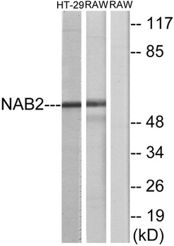 NAB2 rabbit pAb