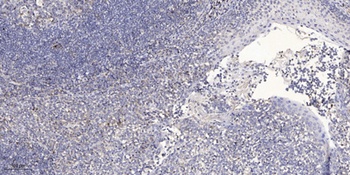 NARFL antibody