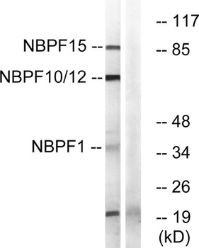 NBPF1/9/10/12/14/15/16/20 rabbit pAb