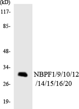 NBPF1/9/10/12/14/15/16/20 rabbit pAb