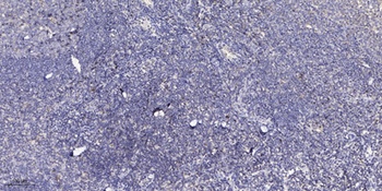 NBPF1/9/10/12/14/15/16/20 antibody