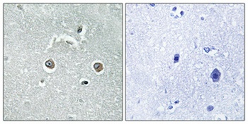 NDUFB10 antibody