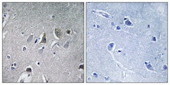 NDUFV2 rabbit pAb
