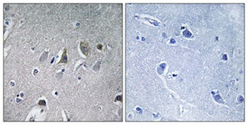 NDUFV2 antibody