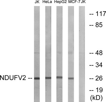 NDUFV2 rabbit pAb