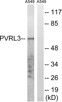 Nectin 3 rabbit pAb