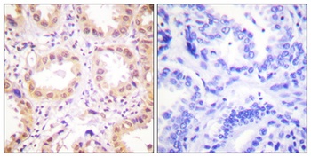 Neddylin antibody