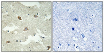 NEEP21 antibody