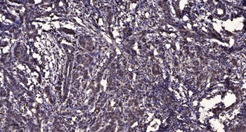 NEIL3 antibody