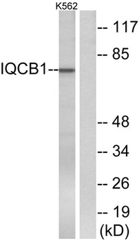 Nephrocystin-5 rabbit pAb