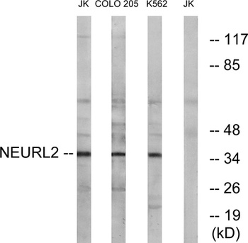 Neuralized-2 rabbit pAb