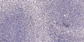 Neuro D2 rabbit pAb