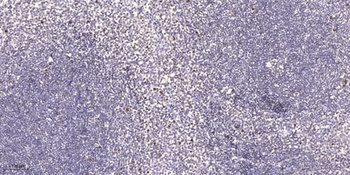 Neuro D2 antibody