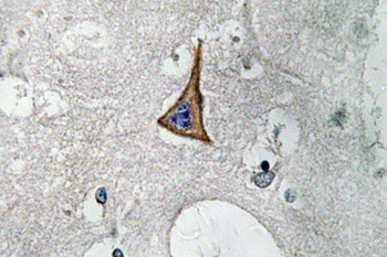 Neuropilin-1 antibody