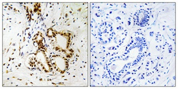 NF2 rabbit pAb