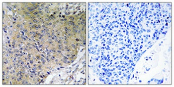 NF2 antibody